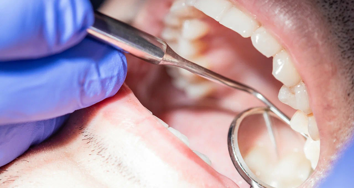 стоматология Савион