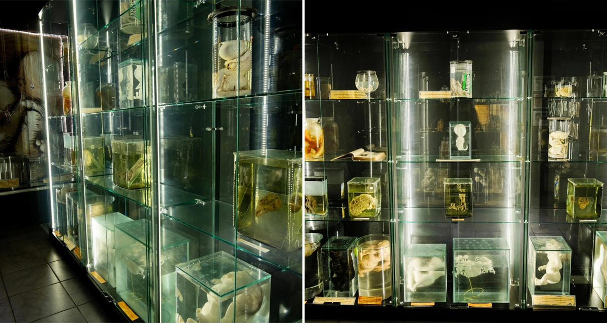 Музей казней и пыток & аномалии тела