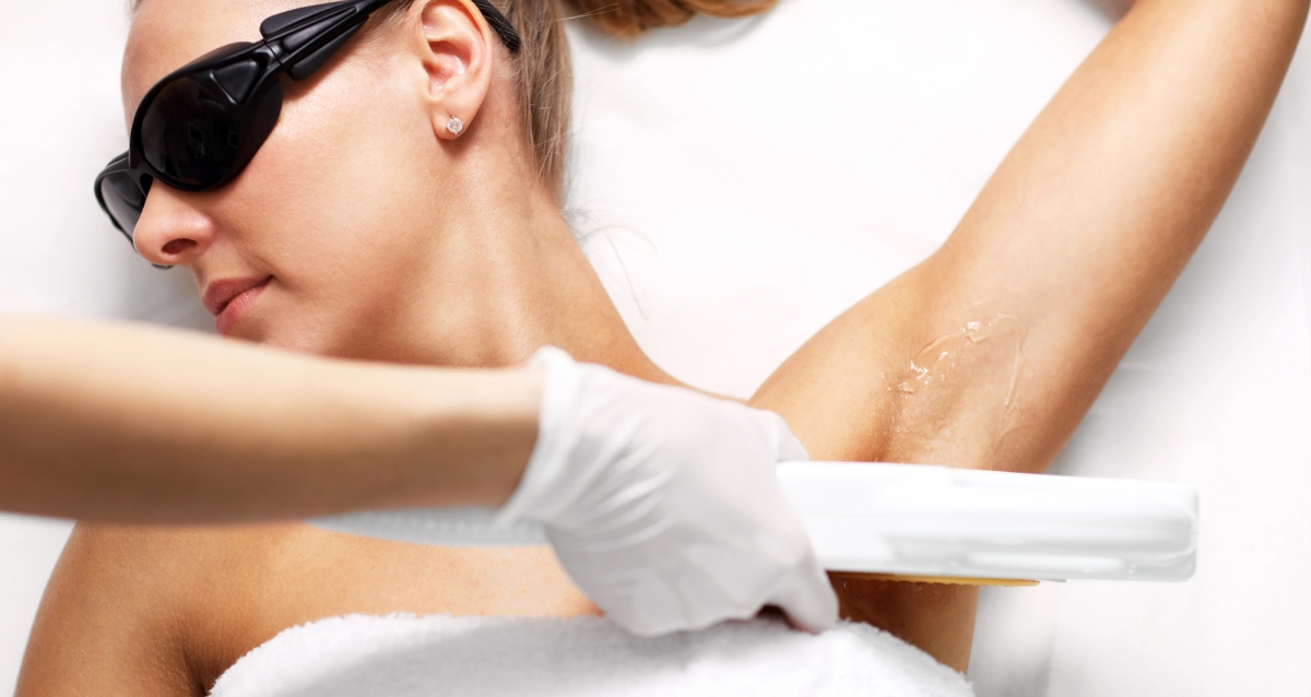 лазерная эпиляция