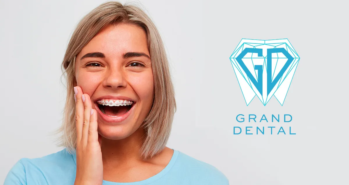 Скидки до 50% на брекеты, имплантацию и гигиену в GRAND DENTAL