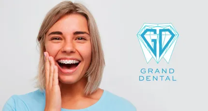 Скидки до 50% на брекеты, имплантацию и гигиену в GRAND DENTAL
