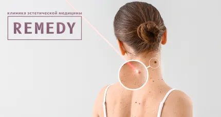 Скидки до 90% на удаление новообразований и сосудов