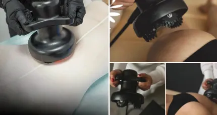 Скидка 55% на массаж на аппарате LovePG SKETCH