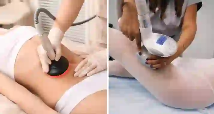 Cкидки до 53% на коррекцию фигуры в студии красоты